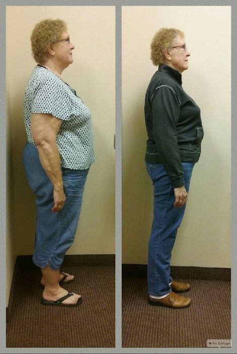 Louise is down over 80 pounds - she said she learned the importance of food choices and portion control.